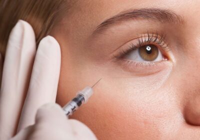 Expert-Botox-Clinic-in-San-Jose