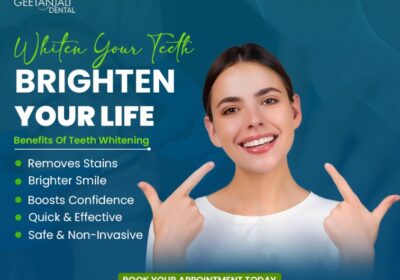 Professional-Teeth-Whitening-In-Gaur-City-For-Bright-Smiles