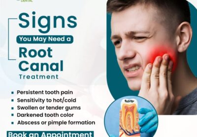 Root-Canal-Treatment-in-Gaur-City-with-Expert-Care-1