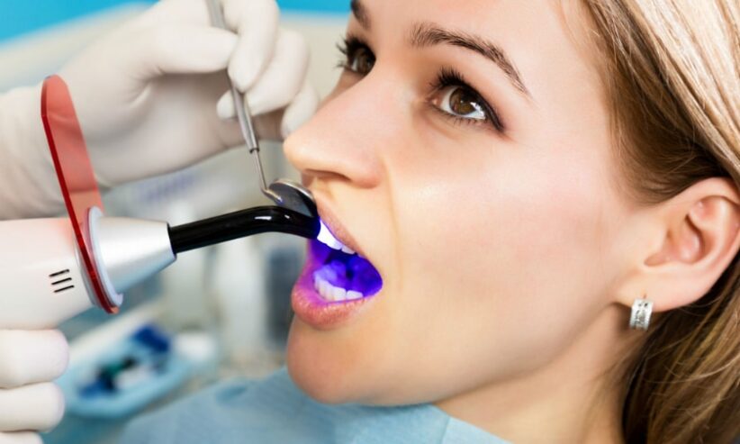 Top-Rated Tooth Sealants in Arlington – Safe, Fast & Painless