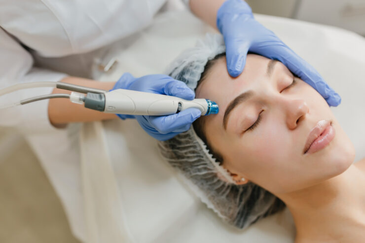 Best Microdermabrasion Treatment in Chennai