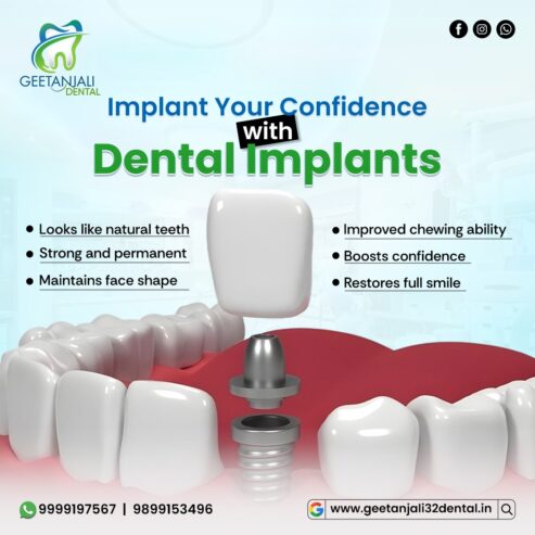 Reliable Dental Implants Near Gaur City