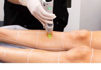 laser-clinics-why-should-you-do-a-full-body-laser-hair-removal