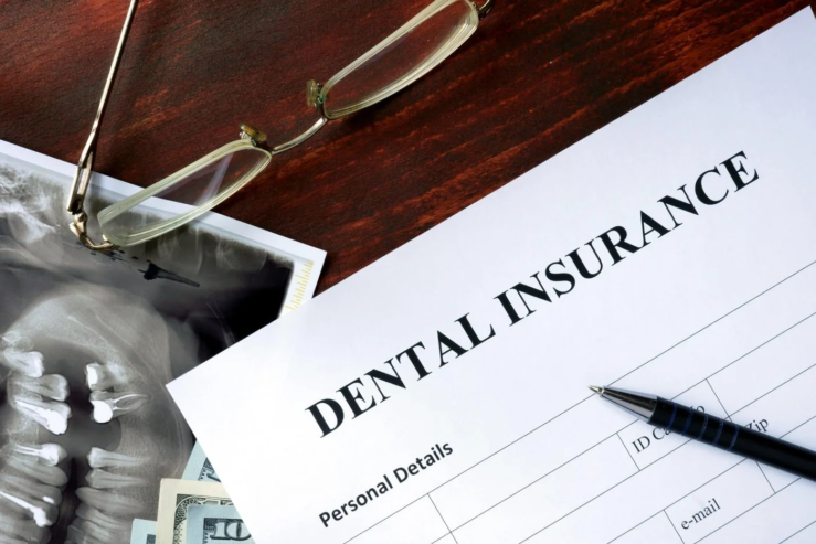 PPO Insurance VA Plans – Save Big on Dental Treatments