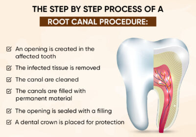 Dental-kraft-26-august