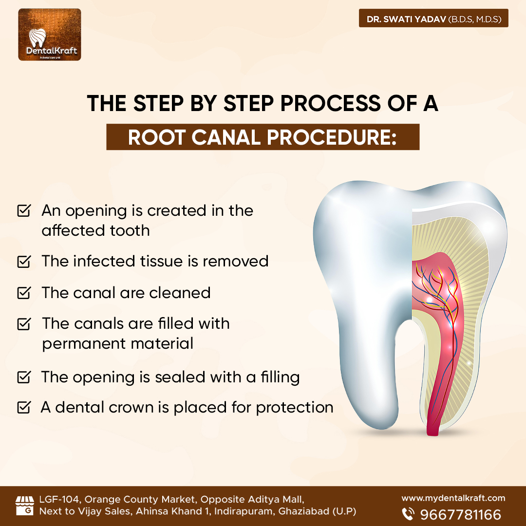 Best RCT Clinic in Indirapuram