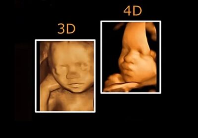 3d-4d-ultrasound-near-me