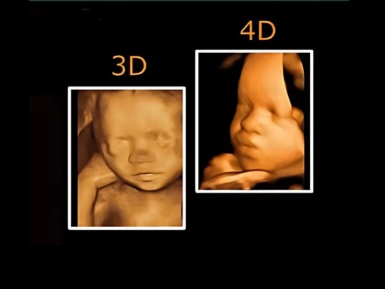 3D & 4D Ultrasound in South Delhi – Advanced Imaging Near You