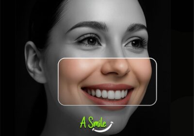 Best-Teeth-Cleaning-in-Gaur-City