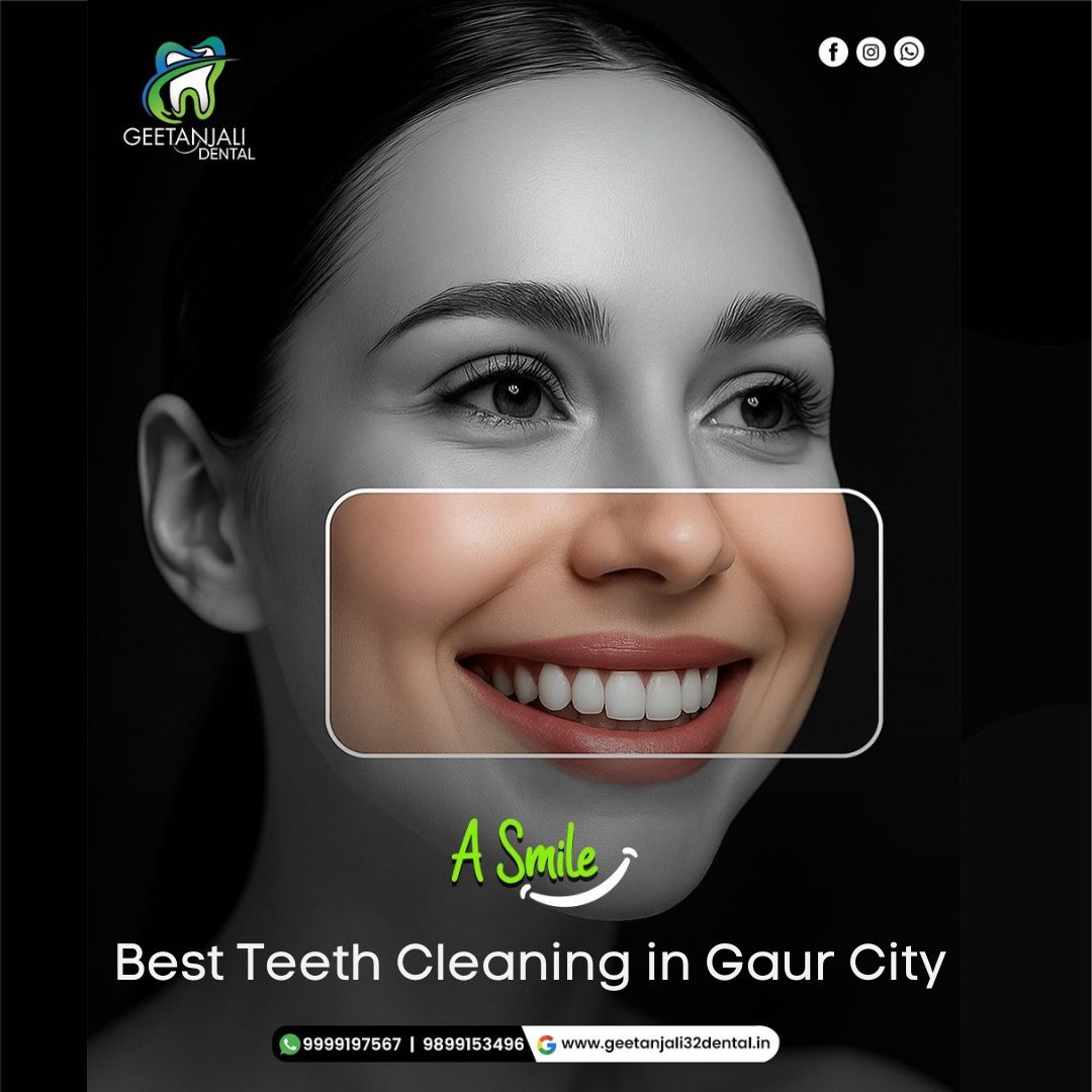 Best Teeth Cleaning in Gaur City