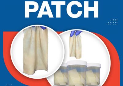 Bovine-Pericardial-Tissue-Patc