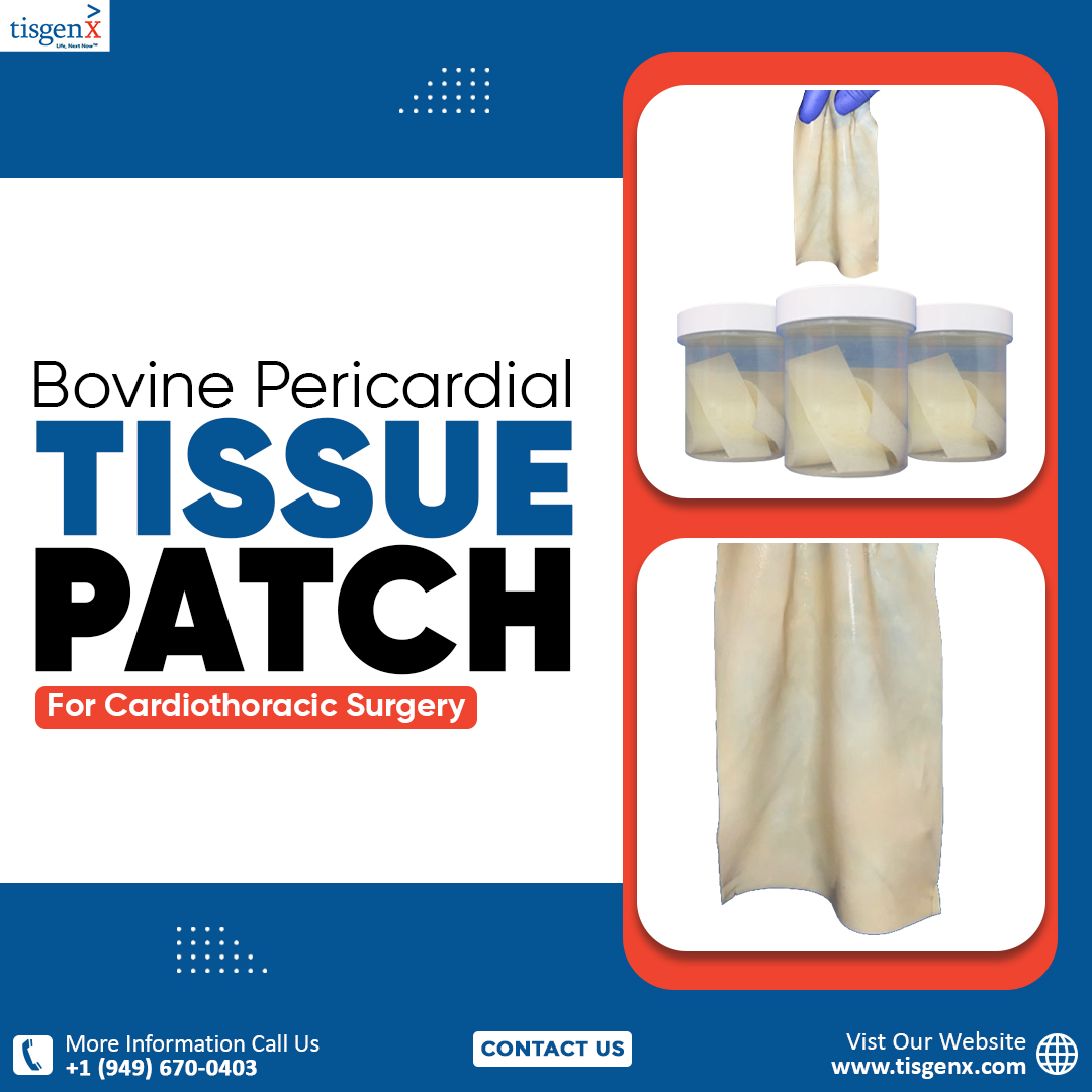 Bovine Pericardial Tissue Patch for Cardiothoracic Surgery