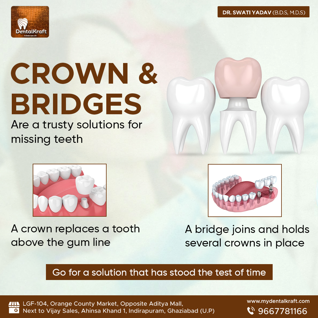 Best Dental Clinic for Tooth Cap Indirapuram