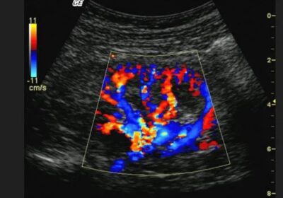 colour-doppler-service-500×500-1