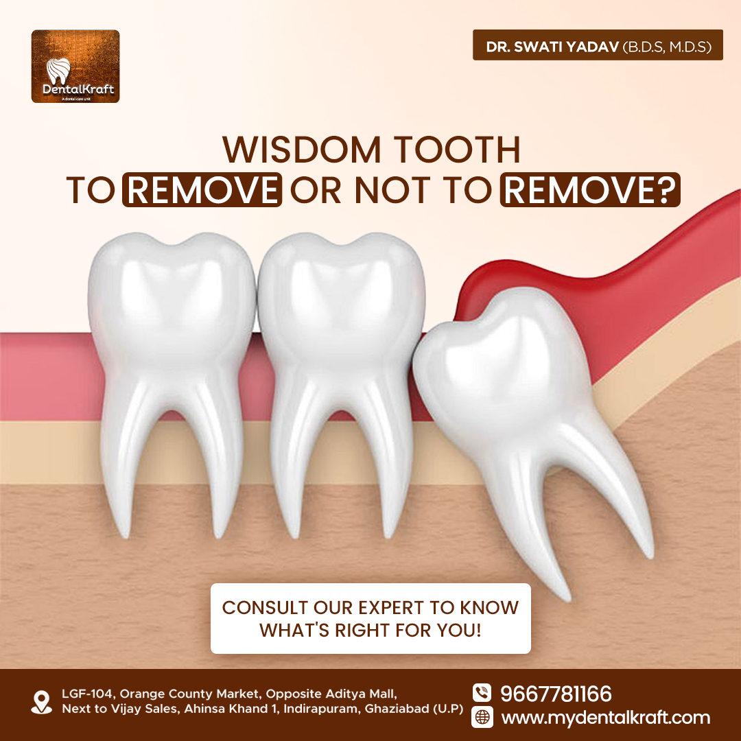 Best Dentist for Tooth Extraction in Indirapuram