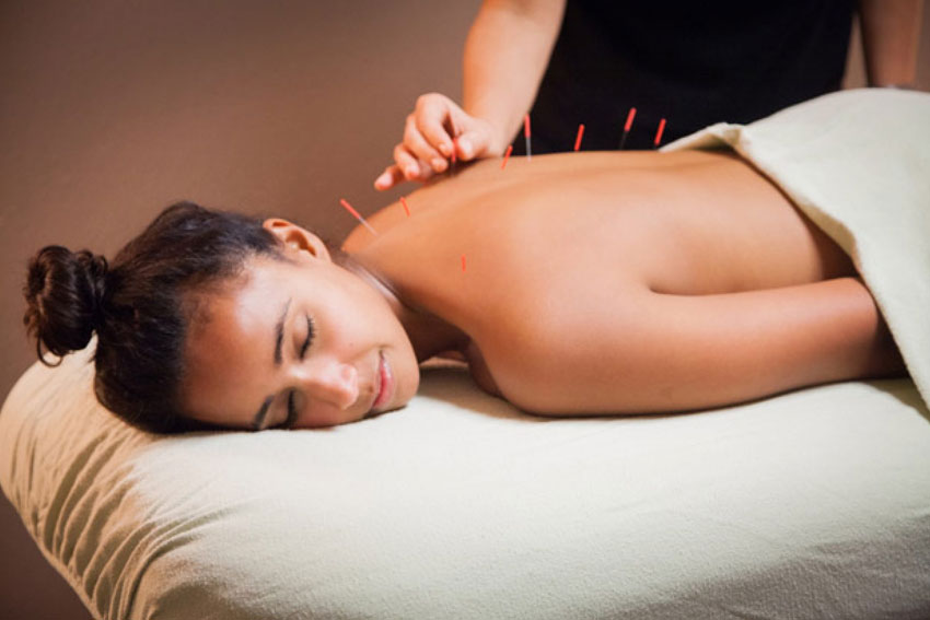 Best Acupuncture Brampton
