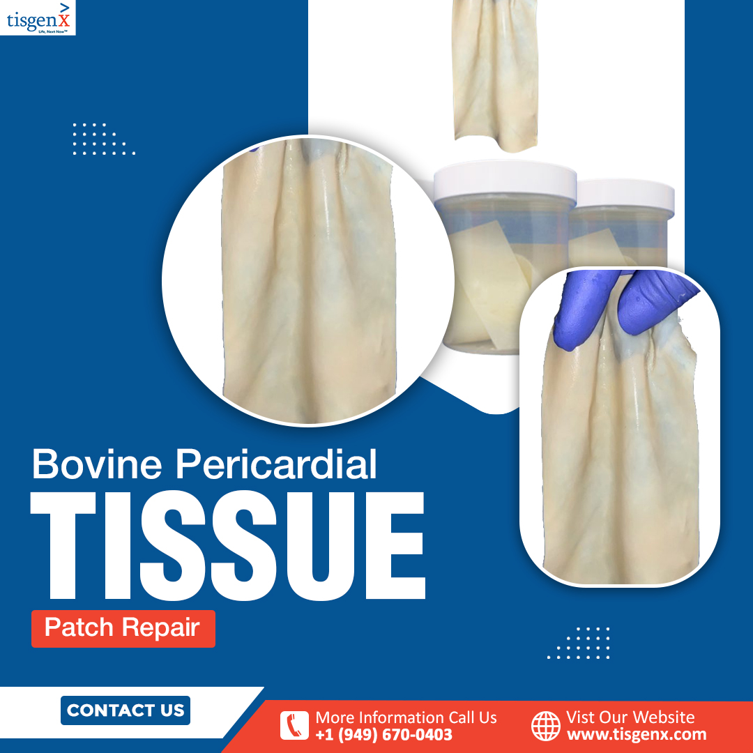 Bovine Pericardial Tissue Patch Repair