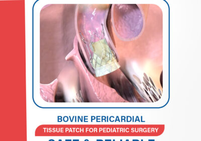 Bovine-Pericardial-Tissue-Patch-for-Pediatric-Surgery-–-Safe-Reliable