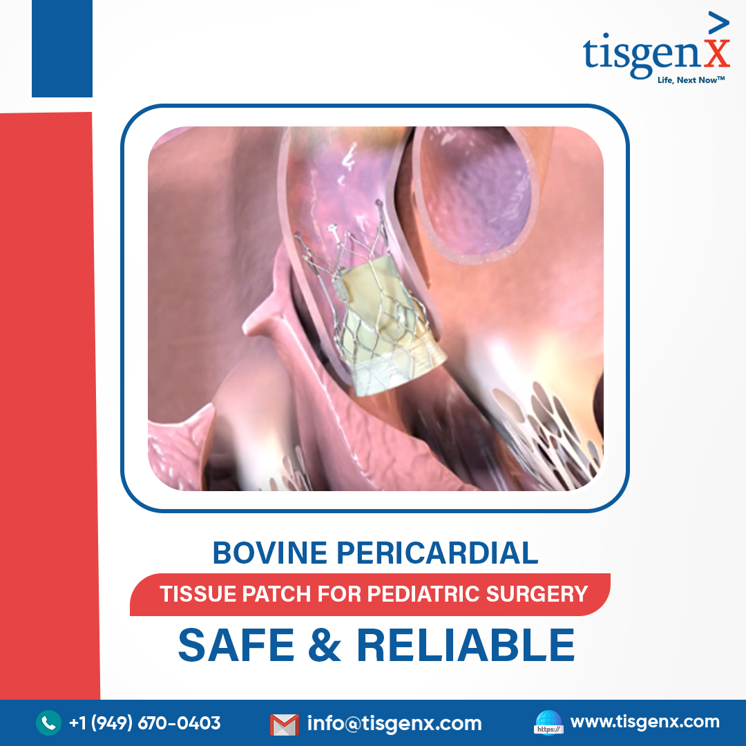 Bovine Pericardial Tissue Patch for Pediatric Surgery – Safe & Reliable