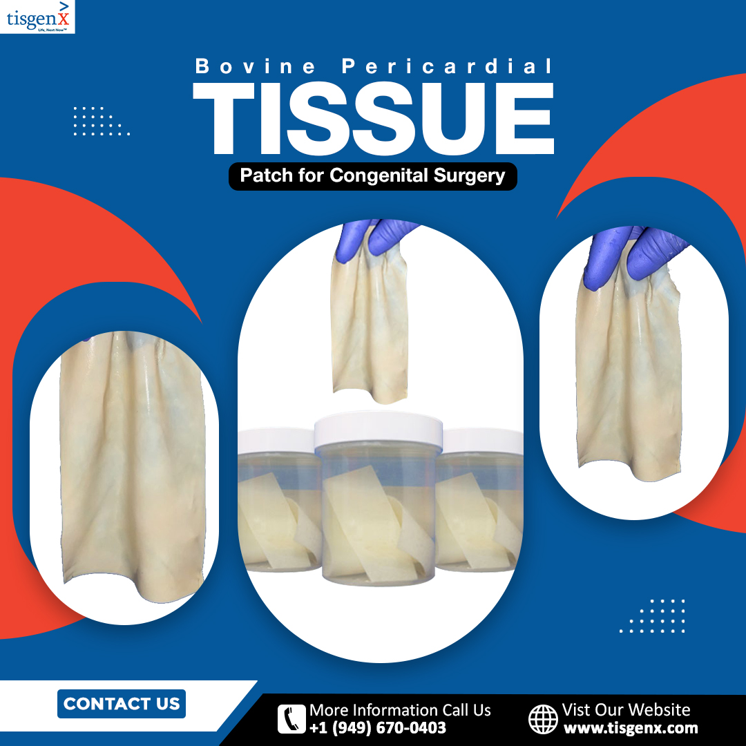 Bovine Pericardial Tissue Patch for congenital surgery