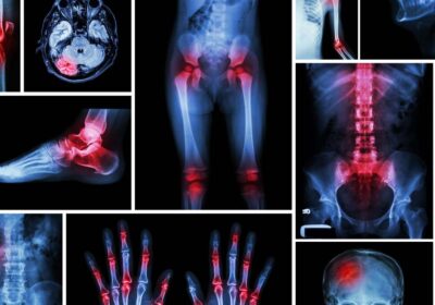 best-orthopedic-doctor-in-delhi