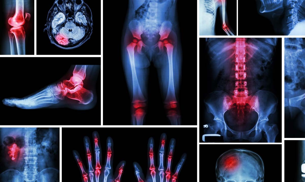 Best Orthopedic Doctor in South Delhi – SVMC