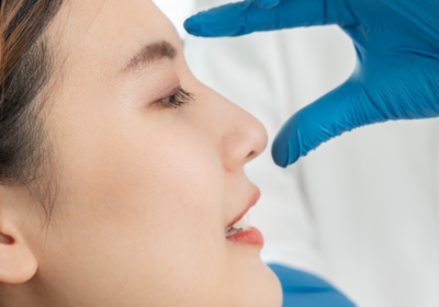 blog_banner_how-long-does-it-take-to-see-the-final-rhinoplasty-results-1