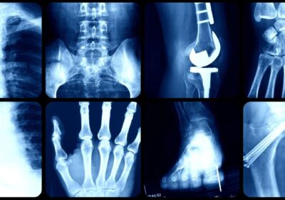 xray-near-me-svmcdelhi