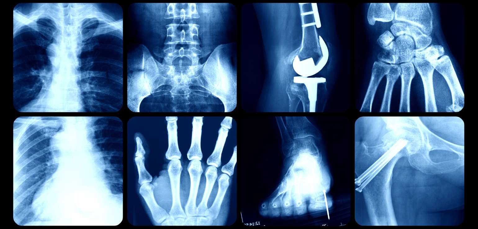 X-ray & OPG Near Me – Trusted Digital X‑Ray Centre in South Delhi