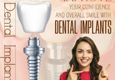 Best-Dental-Implant-Doctor-in-Indirapuram-3