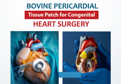Bovine-Pericardial-Tissue-Patch-for-Congenital-Heart-Surgery