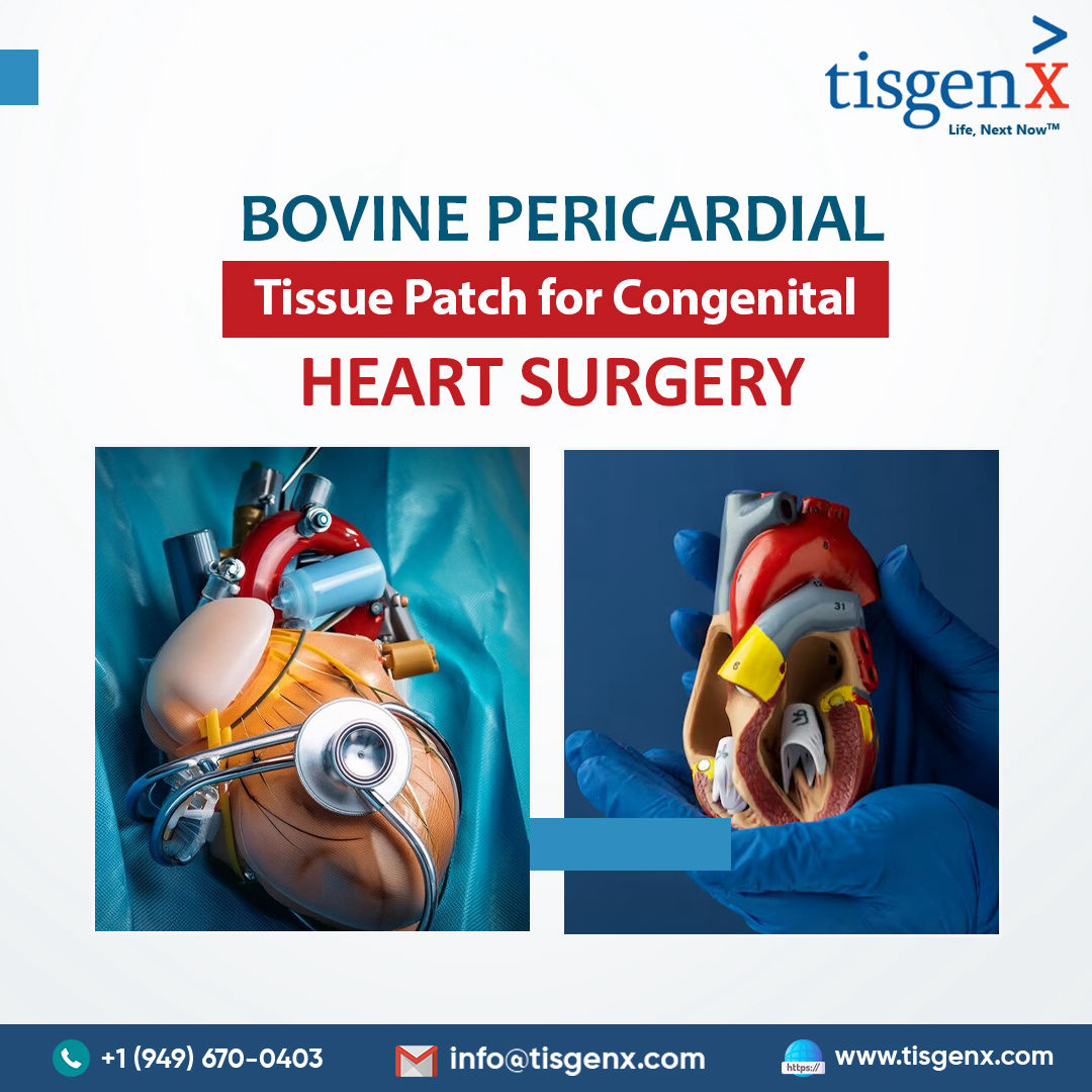 Bovine Pericardial Tissue Patch for Congenital Heart Surgery