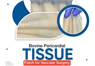 Bovine-Pericardial-Tissue-Patch-for-Vascular-Surgery-–-High-Quality-Surgical-Solution