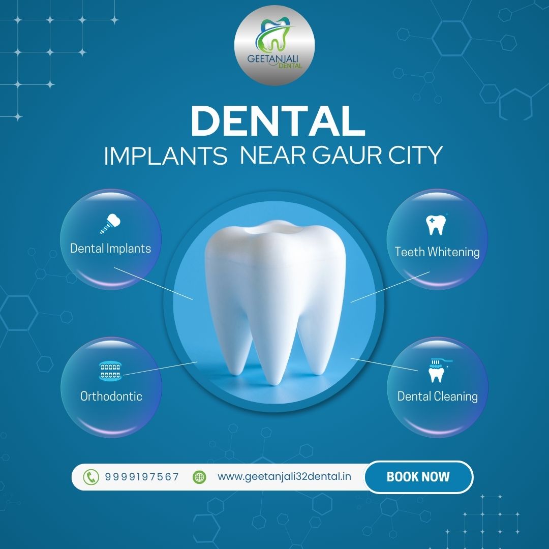 Dental implants near Gaur City with safe and lasting results