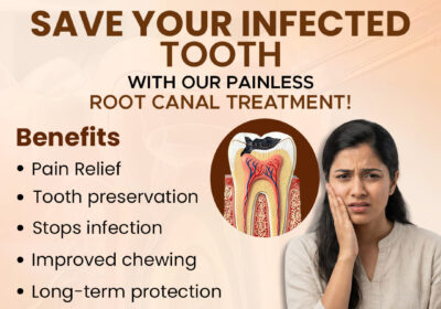 RCT-clinic-in-Indirapuram-offering-precise-root-canal-care
