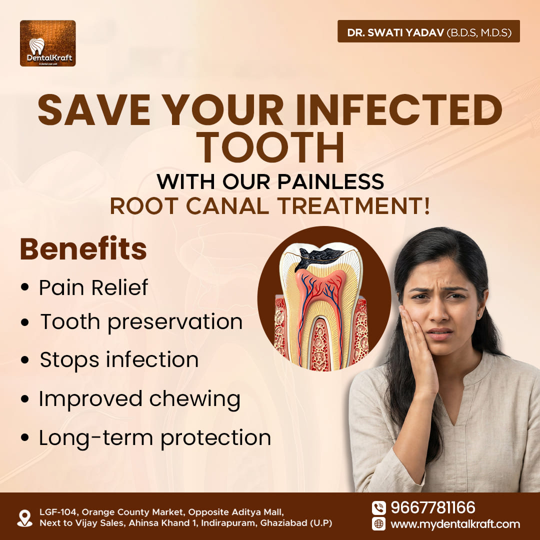 RCT clinic in Indirapuram offering precise root canal care