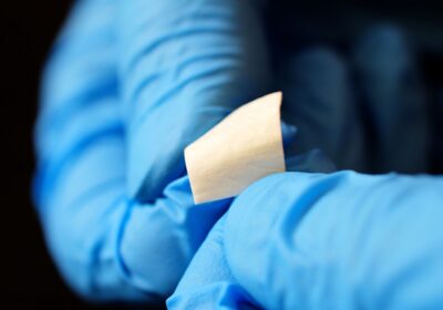 What-is-an-Allograft