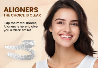 Aligners-Treatment-for-Teeth-Straightening-in-Indirapuram-safely