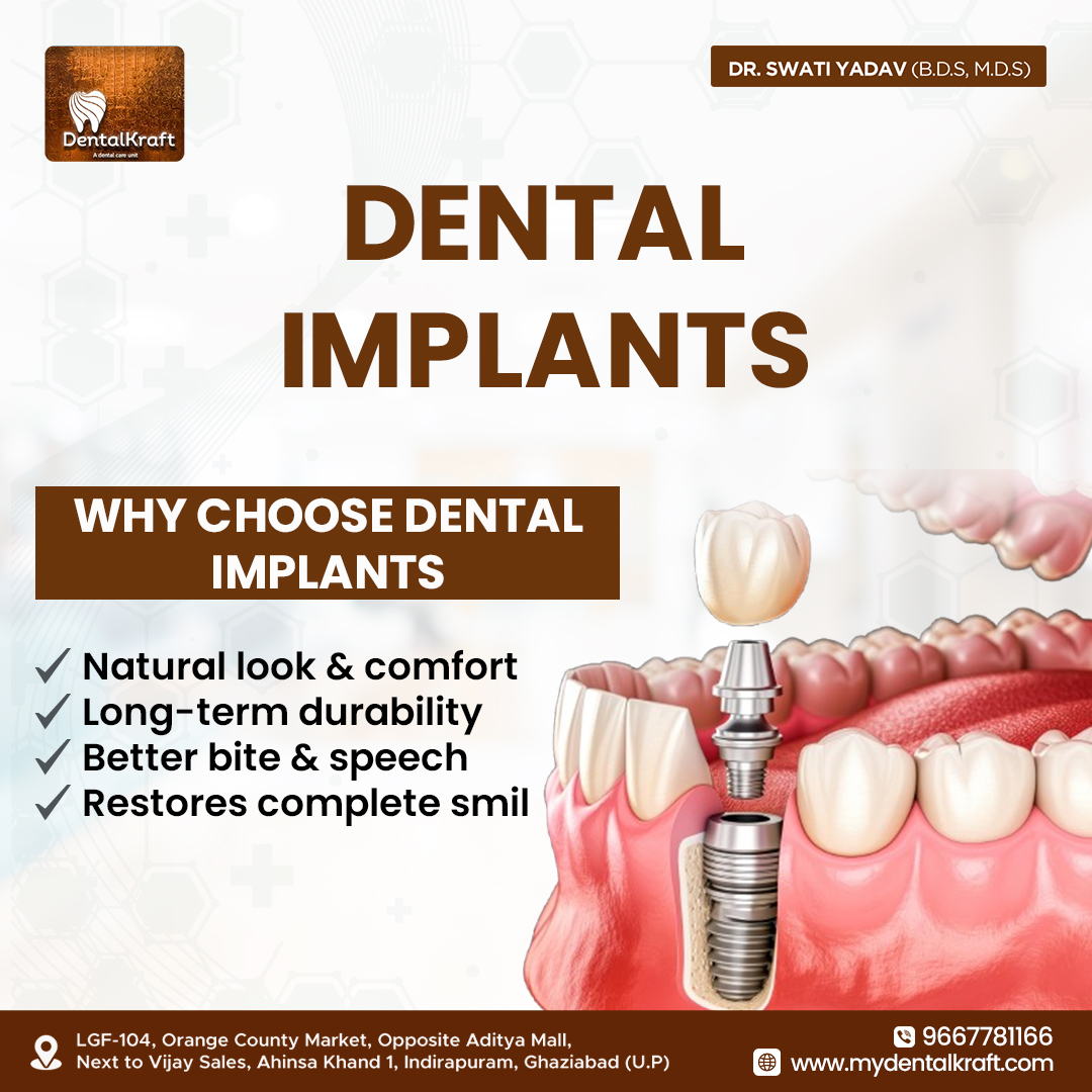 Dental Implant Doctor in Indirapuram for Safe Tooth Replacement