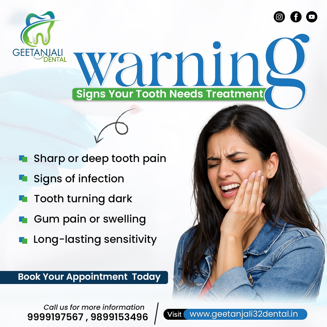 Root Canal Treatment in Gaur City for Safe Dental Care
