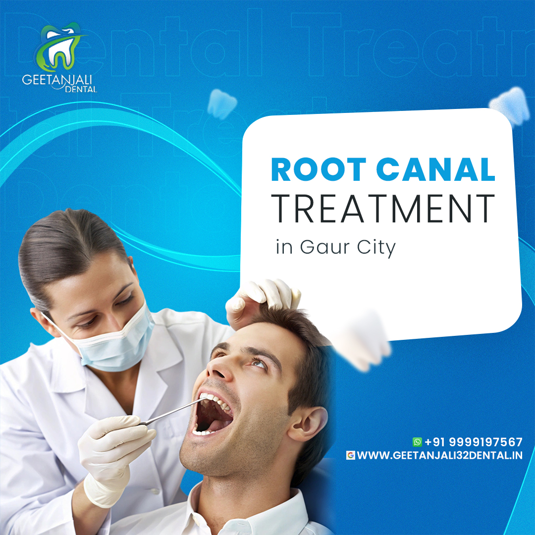 Root canal treatment in Gaur City for tooth protection