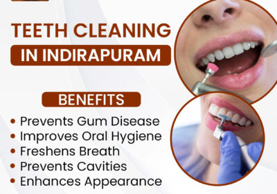 Teeth-Cleaning-in-Indirapuram