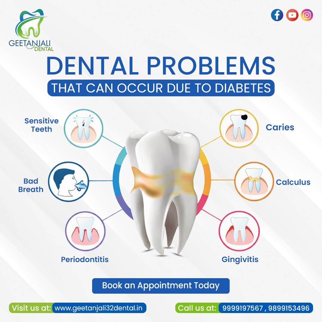 RCT clinic in Gaur City for painless root canal care