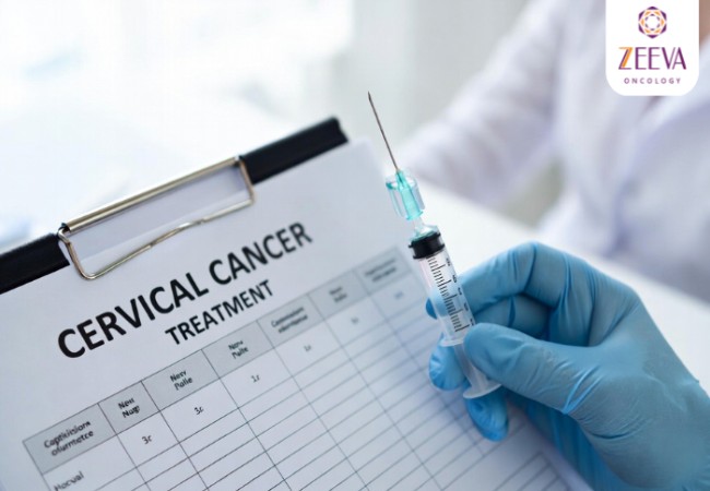 Top Hospital for Advanced Cervical Cancer Treatment in Noida