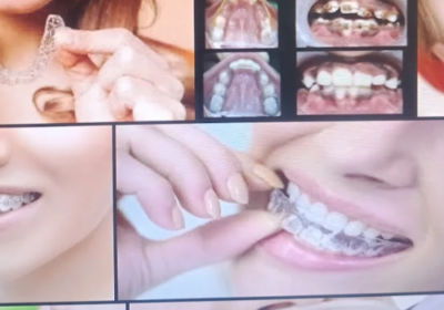 Dr-mathesul-invisalign-Orthodontist