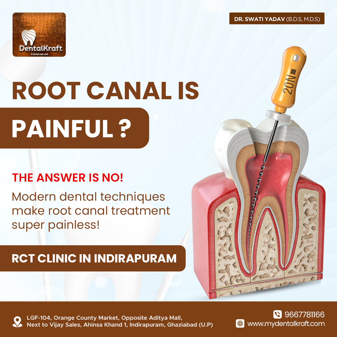 RCT clinic in Indirapuram for painless root canal care