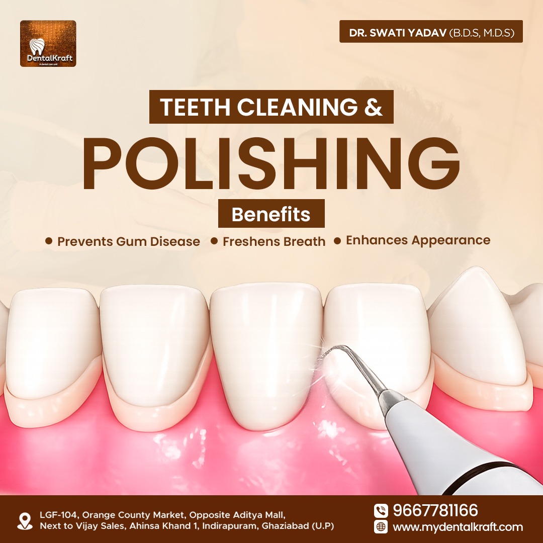 Teeth Cleaning & Polishing Benefits