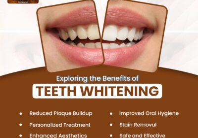 Teeth-whitening-treatment-in-Indirapuram
