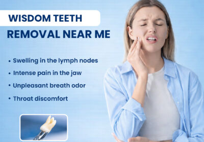 Wisdom-teeth-removal-near-me-2