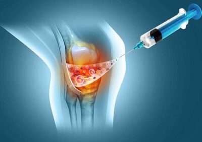 injection-into-the-knee-joint-pl